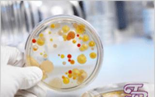 Obnova střevní mikroflóry: pomoc „hodným“ bakteriím v těle